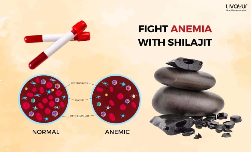 Fight Anemia Low Hemoglobin With Shilajit 1