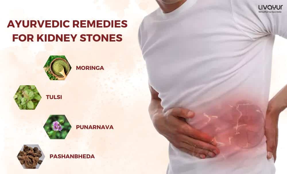 Ayurvedic Remedies Backed By Science for Effective Relief from Kidney Stones