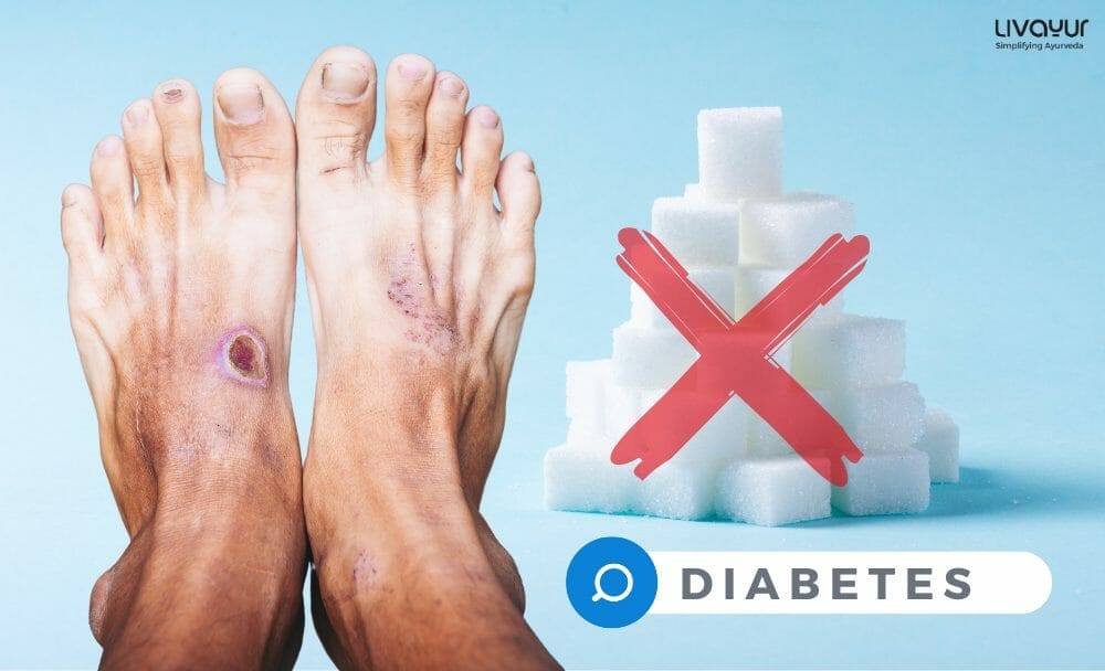 Foot Ulcers Diabetes 2