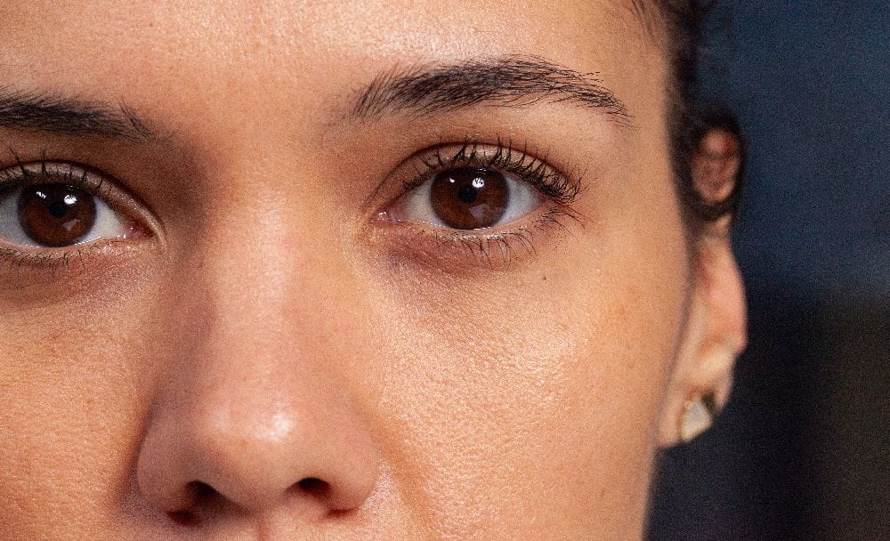 symptoms of leucoderma - loss of pigmentation in the eyes 