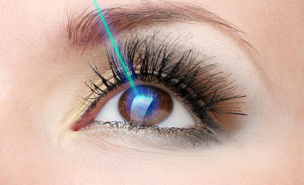 glaucoma treatment - laser therapy