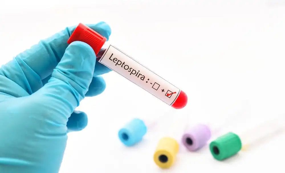 leptospirosis treatment 