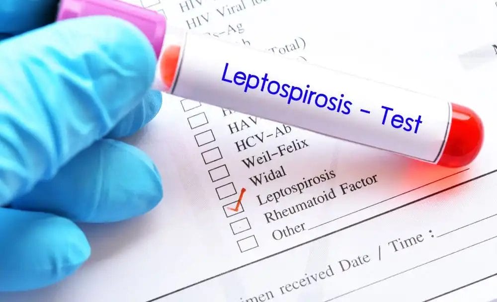 leptospirosis - livayur