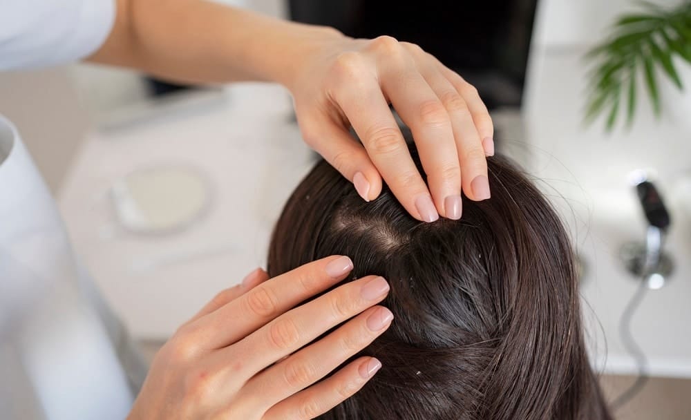 helps in dandruff management - aloe vera benefits for hair