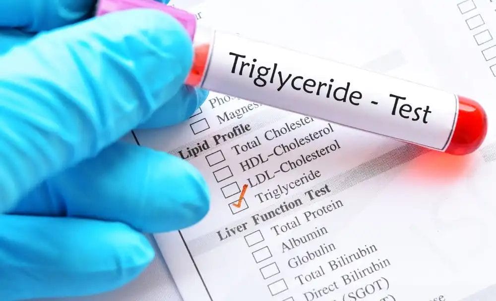High Triglycerides Causes