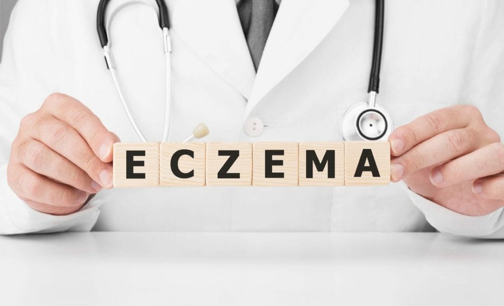symptoms of eczema