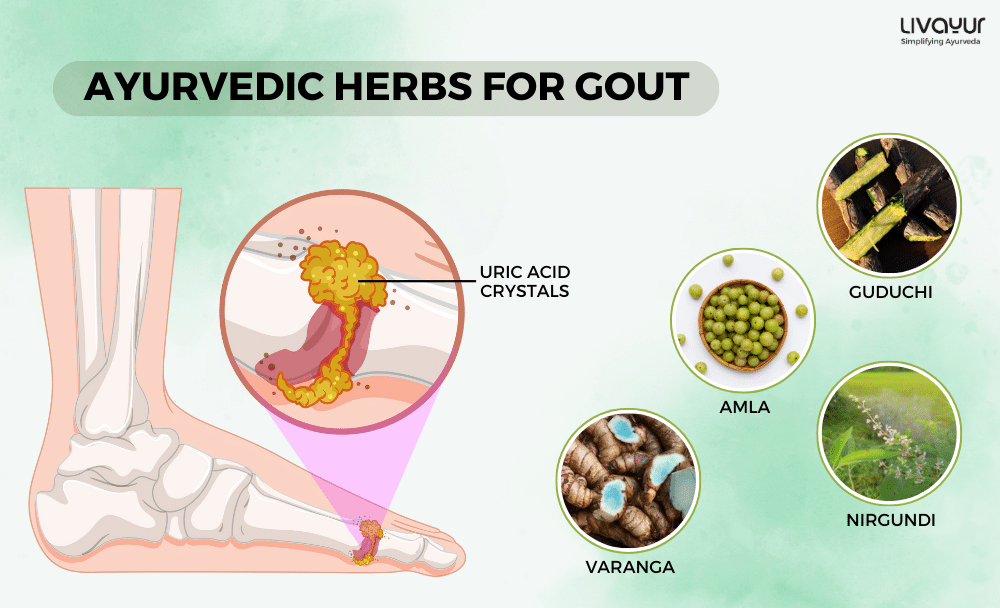 gout treatment - livayur