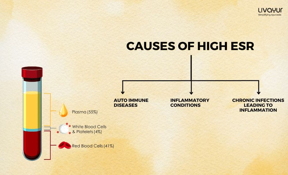 Symptoms of High ESR 3