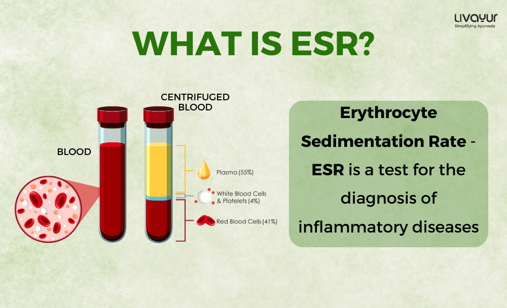 Erythrocyte Sedimentation Rate (ESR) Test: What You Need To Know - Dr Lal  PathLabs Blog