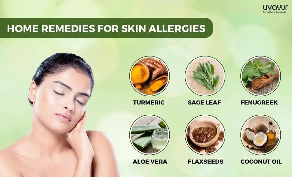 10 Best Home Remedies for Skin Allergies