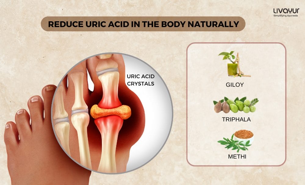 How to Reduce Uric Acid in the Body Naturally