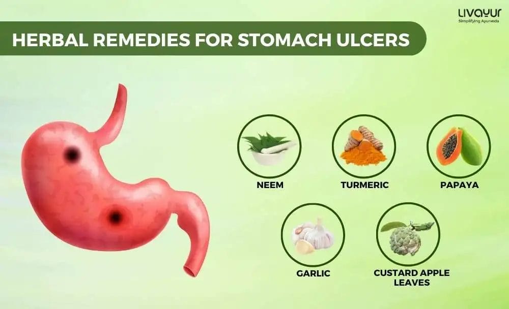 Science Backed Ayurvedic Remedies For The Treatment Of Stomach Ulcers