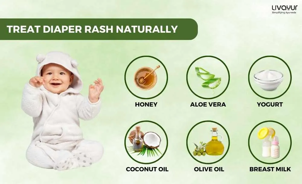Treating Diaper Rash in Babies Naturally 1
